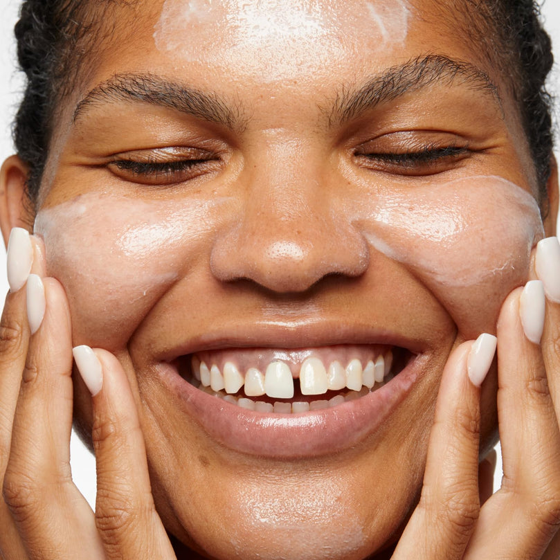 Clinique Acne Solutions All-Over Clearing Treatment, 1.7 Fl Oz